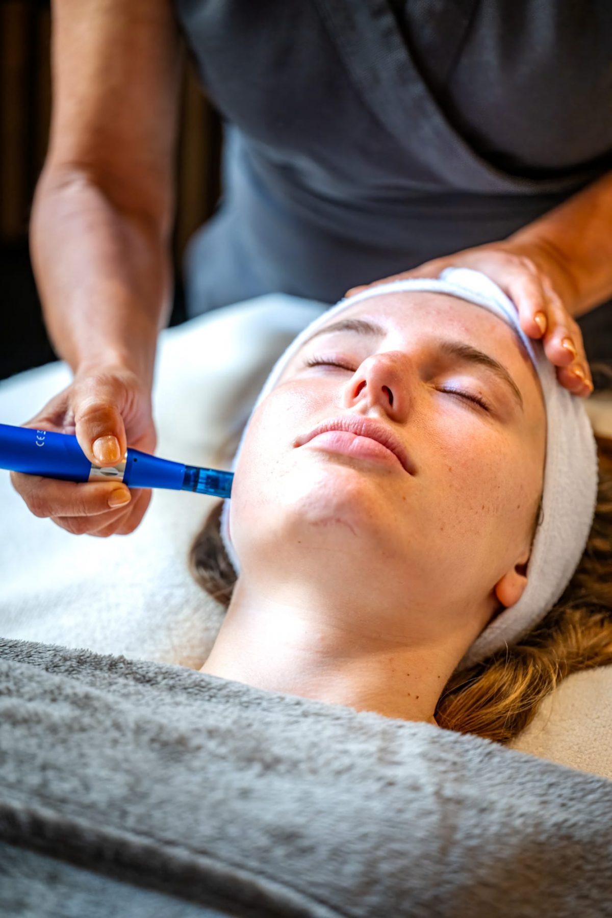 Séance de microneedling du visage à l’institut Beauté Désirée à Nice